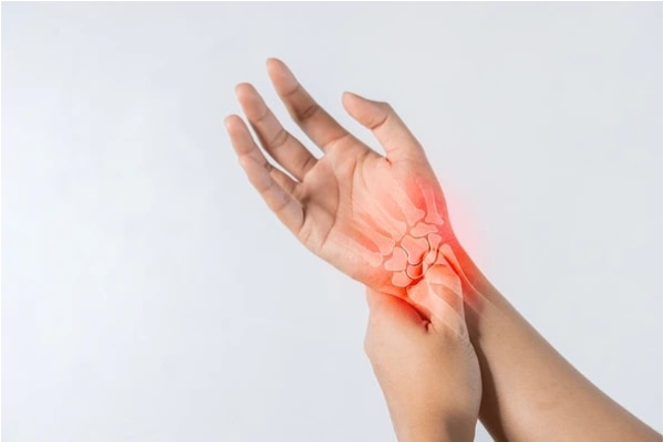 Arthritis Care