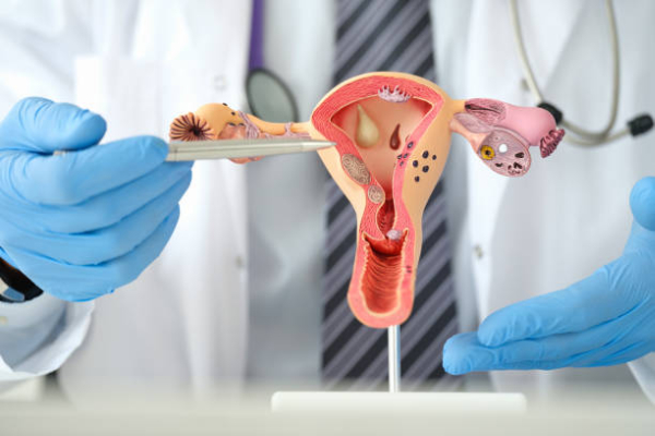 Gynecological Consultation